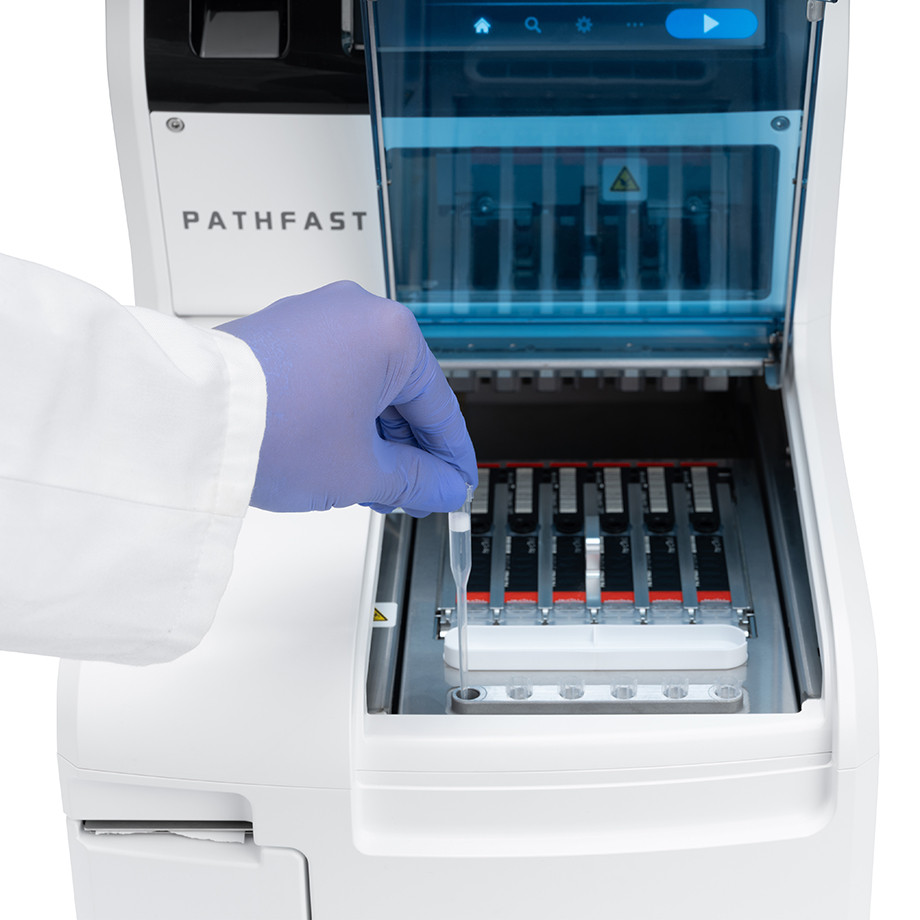 pathfast-immunoanalyzer-type-e-load-front-zoom