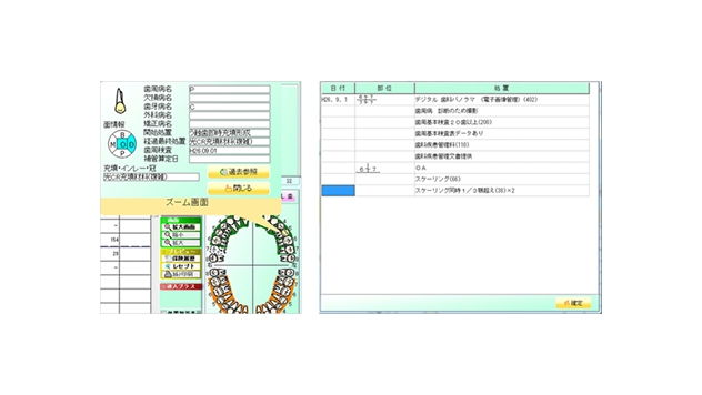 1歯牙単位履歴表示